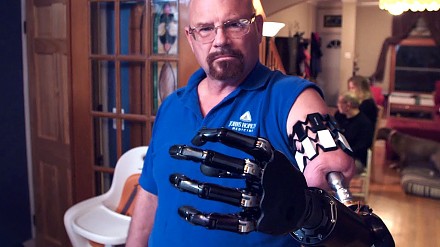 Prawdziwy bioniczny człowiek